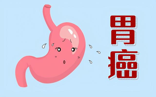 广州哪个中医治疗胃癌好？
