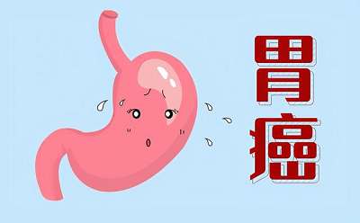 广州肿瘤专科医院|感染了幽门螺杆菌会出现哪些症状