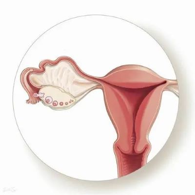 广州治疗子宫内膜癌老中医:子宫内膜癌是什么原因发生的