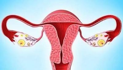 广州肿瘤老中医:卵巢癌早期有哪些明显症状呢