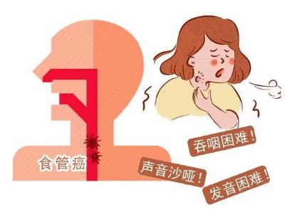 广州中医肿瘤科医院科普|不良睡姿会诱发食管癌,消化不好左侧睡