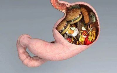 广州治疗胃癌老中医:什么是胃息肉?胃息肉会变成胃癌吗