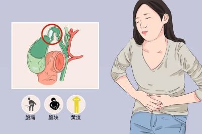 广州中医肿瘤医师张忠民:中医治疗晚期胆管癌有很大的优势