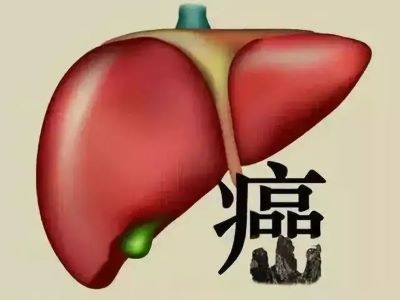 为什么我国肝癌患者这么多?中医又是怎么治疗的？