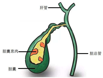 老中医张忠民:这些因素也决定着胆囊癌患者术后的寿命