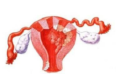 老中医张忠民:年轻女子若有这三处异常要警惕宫颈癌