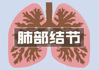 广州中医医师:除了二手烟,预防肺癌还要杜绝这些坏习惯