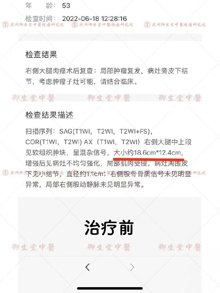 广州御和堂守护每一位患者的健康